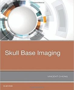 Skull Base Imaging PDF