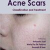 Acne Scars: Classification and Treatment (Series in Dermatological Treatment) 1st Edition PDF