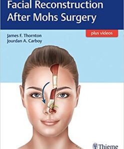 Facial Reconstruction After Mohs Surgery 1st Edition PDF & VIDEO