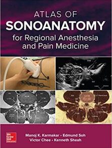 Atlas of Sonoanatomy for Regional Anesthesia and Pain Medicine EPUB