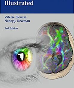 Neuro-Ophthalmology Illustrated 2nd Edition PDF