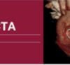 2018 Classic Lectures in Cardiac CTA video