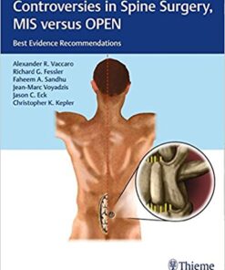 Controversies in Spine Surgery, MIS versus OPEN: Best Evidence Recommendations 1st Edition PDF