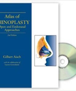 Atlas of Rhinoplasty, Second Edition 2nd Edition PDF