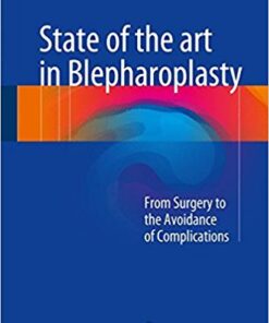 State of the art in Blepharoplasty: From Surgery to the Avoidance of Complications 1st ed. 2017 Edition PDF