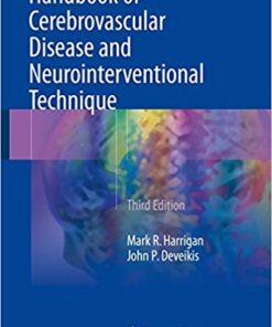 Handbook of Cerebrovascular Disease and Neurointerventional Technique (Contemporary Medical Imaging) 3rd ed. 2018 Edition PDF