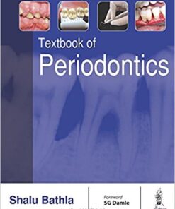 Textbook of Periodontics 1st Edition PDF