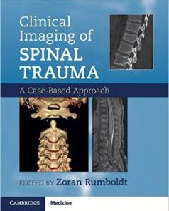 Clinical Imaging of Spinal Trauma A Case-Based Approach PDF