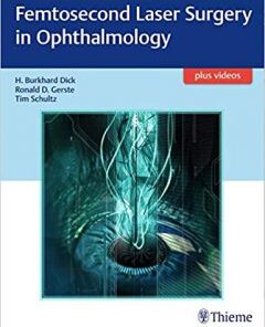 Femtosecond Laser Surgery in Ophthalmology PDF