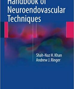 Handbook of Neuroendovascular Techniques 1st ed. 2017 Edition PDF