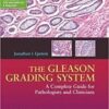 The Gleason Grading System: A Complete Guide for Pathologist and Clinicians