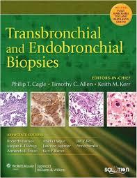 Transbronchial and Endobronchial Biopsies