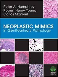 Neoplastic Mimics in Genitourinary Pathology (Pathology of Neoplastic Mimics) 1st Edition