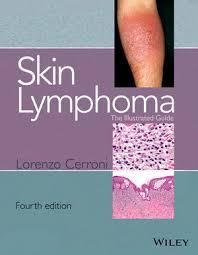 Skin Lymphoma: The Illustrated Guide 4th Edition