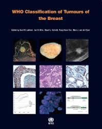 WHO Classification of Tumours of the Breast (IARC WHO Classification of Tumours)