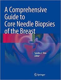 A Comprehensive Guide to Core Needle Biopsies of the Breast 1st