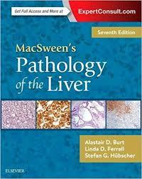 MacSween's Pathology of the Liver E-Book 7th