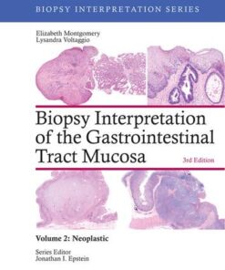 Biopsy Interpretation of the Gastrointestinal Tract Mucosa: Volume 2: Neoplastic (Biopsy Interpretation Series)