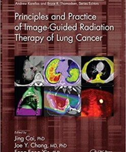 Principles and Practice of Image-Guided Radiation Therapy of Lung Cancer (Imaging in Medical Diagnosis and Therapy) 1st