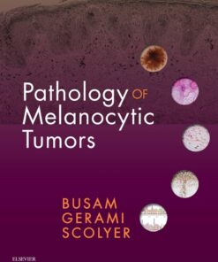 Pathology of Melanocytic Tumors