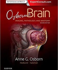 Osborn's Brain 2nd Edition