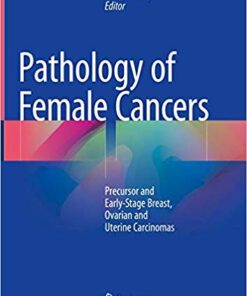 Pathology of Female Cancers: Precursor and Early-Stage Breast, Ovarian and Uterine Carcinomas 1st ed. 2018 Edition