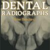 Interpreting Dental Radiographs Softcover reprint of the original 1st ed. 1981 Edition pdf