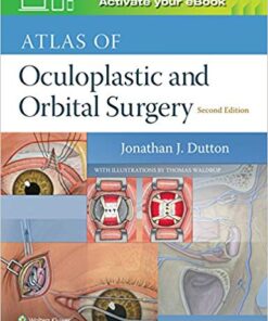 Atlas of Oculoplastic and Orbital Surgery Second Edition PDF