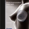 Video & PDF Breast Augmentation Video Atlas