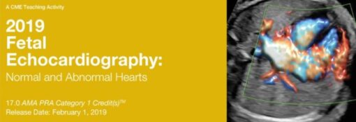 2019 Fetal Echocardiography: Normal and Abnormal Hearts - A Video CME Teaching Activity