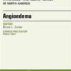 Angioedema, An Issue of Immunology and Allergy Clinics of North America, 1e (The Clinics: Internal Medicine)