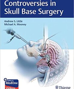 Controversies in Skull Base Surgery 1st Edition PDF & VIDE0