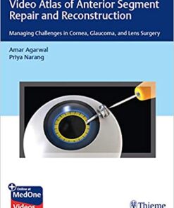 Video Atlas of Anterior Segment Repair and Reconstruction: Managing Challenges in Cornea, Glaucoma, and Lens Surgery PDF & VIDEO