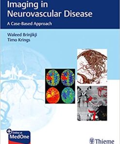 Imaging in Neurovascular Disease: A Case-Based Approach 1st Edition PDF