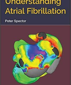 Understanding Atrial Fibrillation 1st Edition PDF