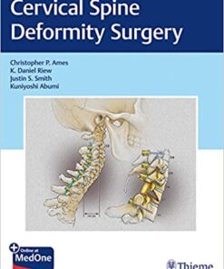 Cervical Spine Deformity Surgery 1st Edition PDF