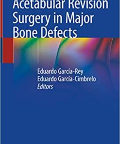 Acetabular Revision Surgery in Major Bone Defects 1st ed. 2019 Edition