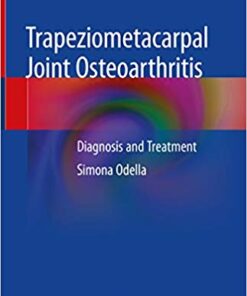 Trapeziometacarpal Joint Osteoarthritis: Diagnosis and Treatment 1st ed. 2018 Edition