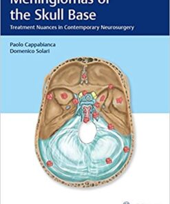 Meningiomas of the Skull Base: Treatment Nuances in Contemporary Neurosurgery 1st Edition