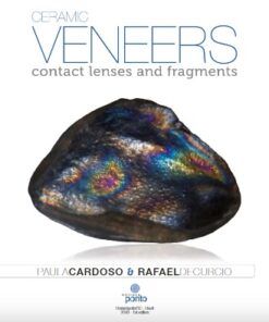 Ceramic veneers: contact lenses and fragments PDF