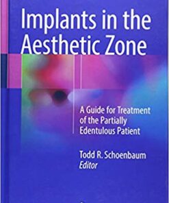 Implants in the Aesthetic Zone: A Guide for Treatment of the Partially Edentulous Patient 1st ed. 2019 Edition PDF