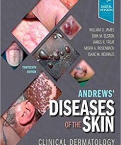 Andrews' Diseases of the Skin: Clinical Dermatology 13th ed. Edition