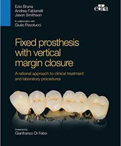 Fixed prosthesis with vertical margin closure: A rational approach to clinical treatment and to laboratory PDF