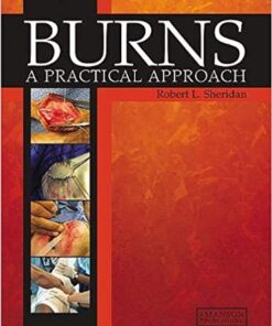 Burns: A Practical Approach to Immediate Treatment and Long Term Care 1st Edition PDF