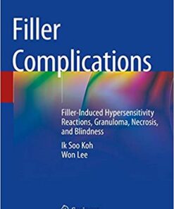 Filler Complications: Filler-Induced Hypersensitivity Reactions, Granuloma, Necrosis, and Blindness 1st ed. 2019 Edition PDF