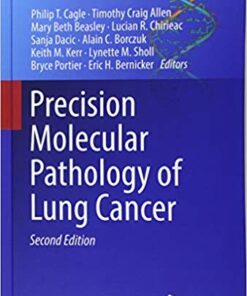 Precision Molecular Pathology of Lung Cancer (Molecular Pathology Library) PDF