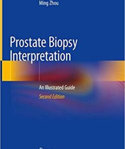 Prostate Biopsy Interpretation: An Illustrated Guide 2nd ed. 2019 Edition PDF