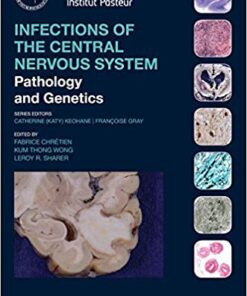 Infections of the Central Nervous System: Pathology and Genetics (International Society of Neuropathology Series) 1st Edition PDF