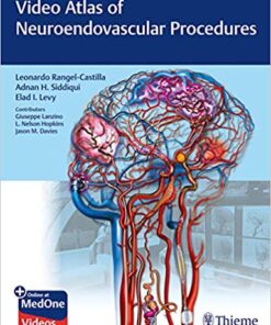 Video Atlas of Neuroendovascular Procedures 1st Edition PDF & VIDEO