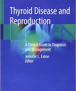 Thyroid Disease and Reproduction: A Clinical Guide to Diagnosis and Management 1st ed. 2019 Edition PDF